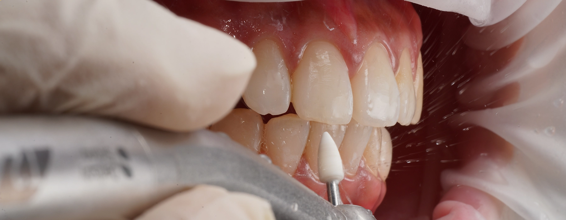 Dental Photography – Expand your knowledge beyond